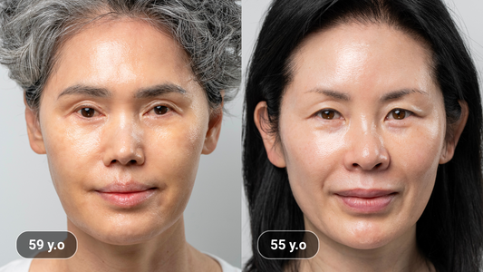 [Click Here] It’s Not Genetics. The Real Reason Koreans Look 10 Years Younger Is a Habit You Can Start Today.