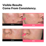 Full Care Set - For Texture&Pore