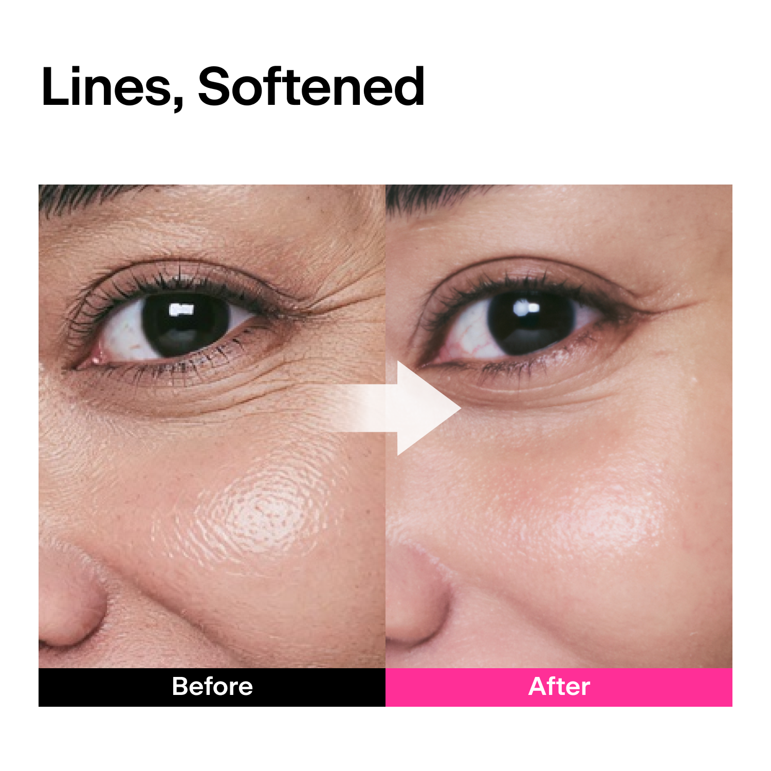 CPR Triple-Synergy Wrinkle Care Serum