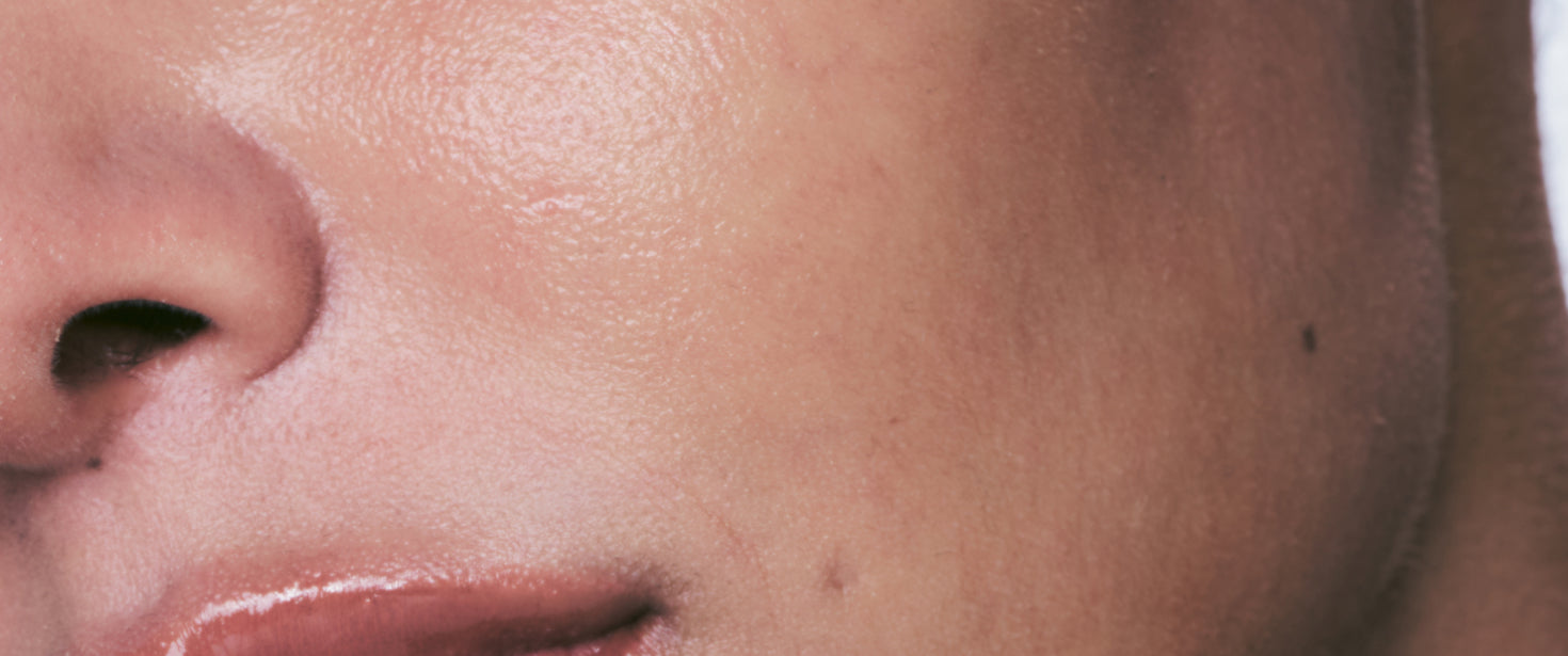 RESULT: 10-DIMENSION WRINKLE CARE