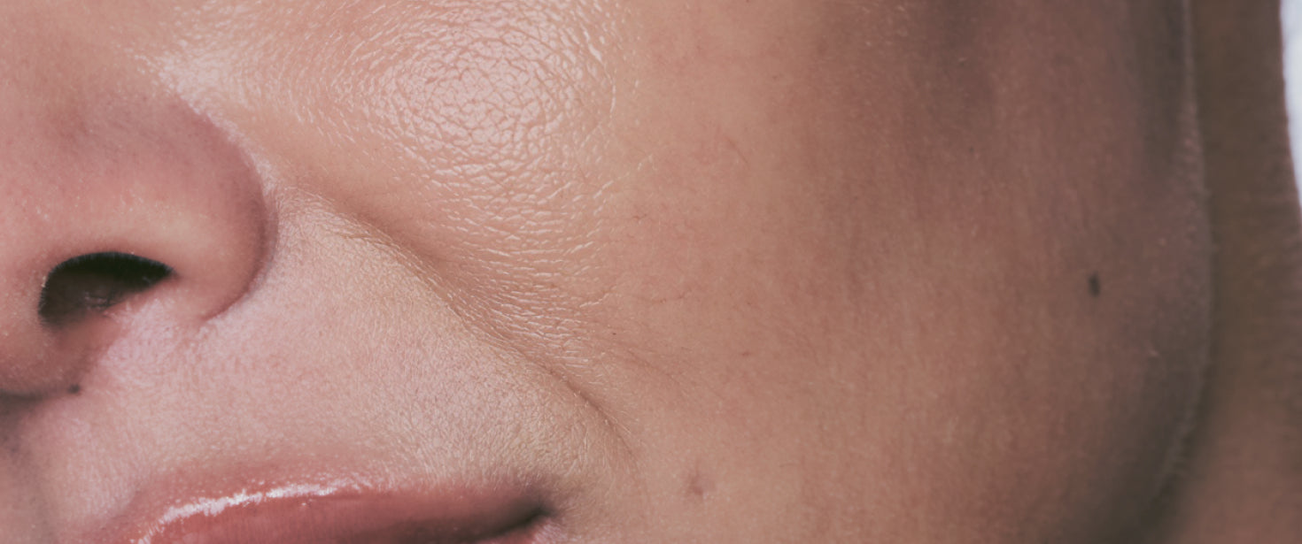 RESULT: 10-DIMENSION WRINKLE CARE